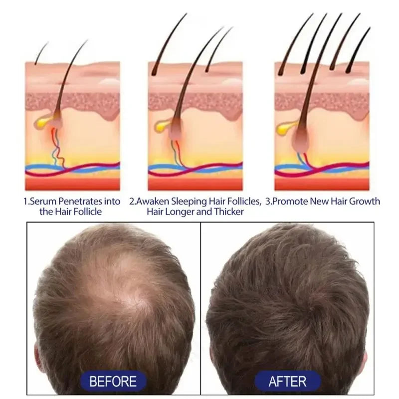 Fibras capilares Toppik